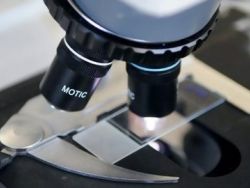 Cientistas Espanhóis desenvolvem vacina contra Alzheimer.